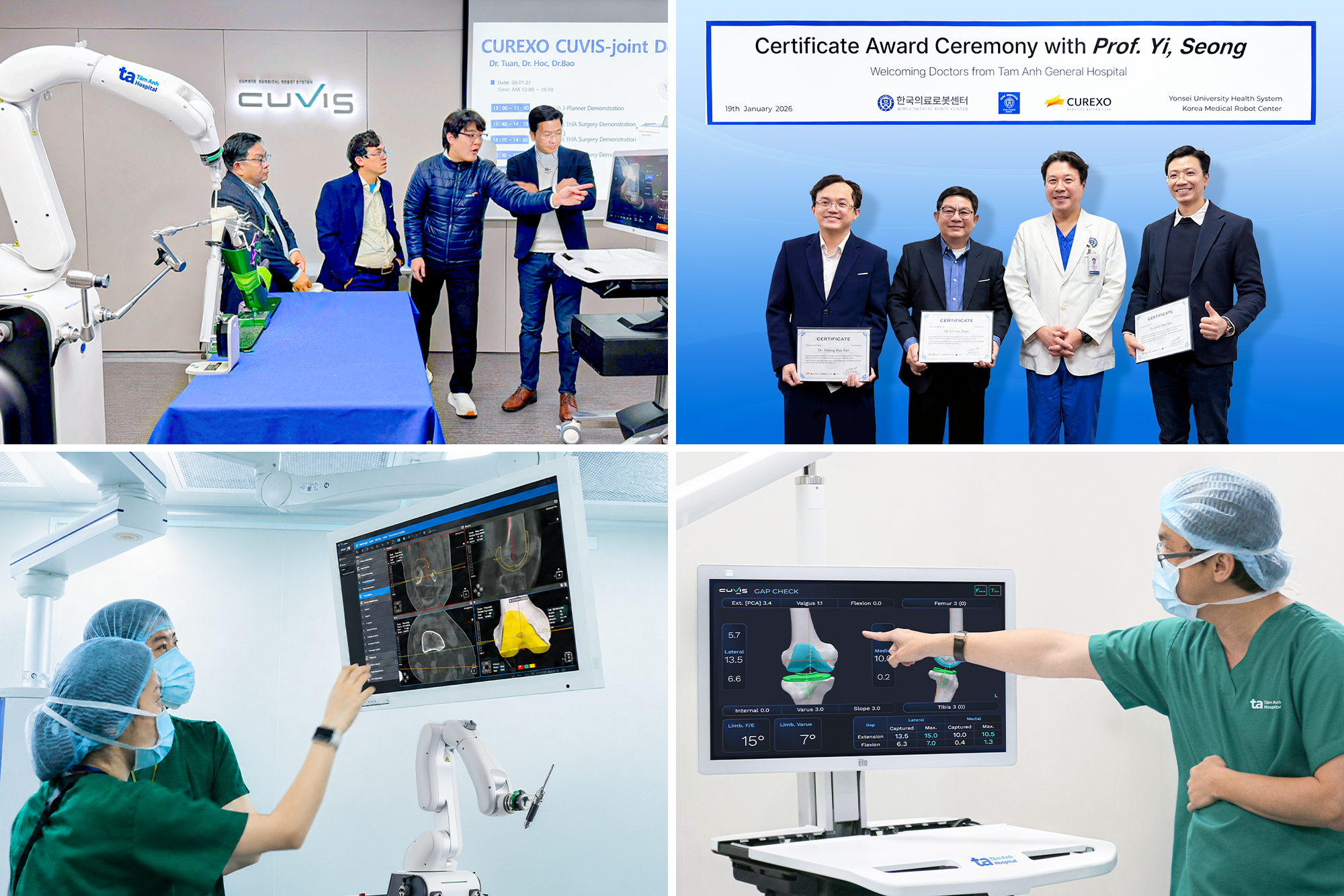 Top đầu thế giới, Bệnh viện Việt Nam vượt mốc 100 ca thay khớp khó nhờ “siêu robot” AI
